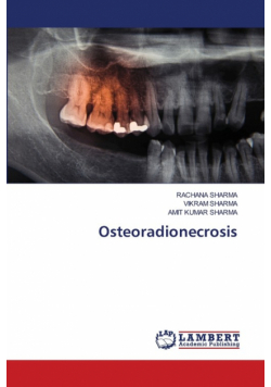 Osteoradionecrosis