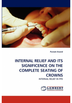 Internal Relief And Its Significence On The Complete Seating Of Crowns