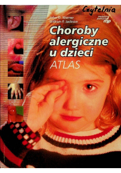 Choroby alergiczne u dzieci