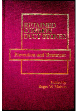 Retained common duct stones