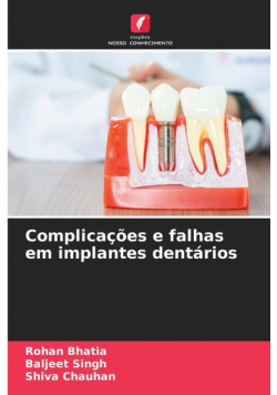 Complicações e falhas em implantes dentários