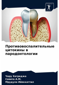 Противовоспалительные цитокины в пародонтологии