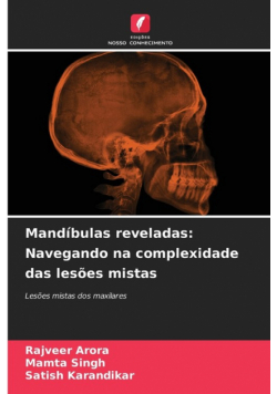 Mandíbulas reveladas