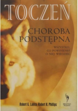 Toczeń choroba podstępna