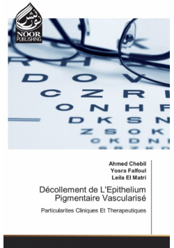 Décollement de L'Epithelium Pigmentaire Vascularisé