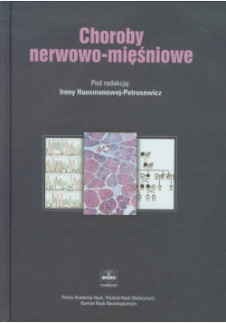 Choroby nerwowo mięśniowe