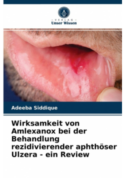 Wirksamkeit von Amlexanox bei der Behandlung rezidivierender aphthöser Ulzera - ein Review