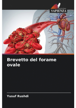 Brevetto del forame ovale