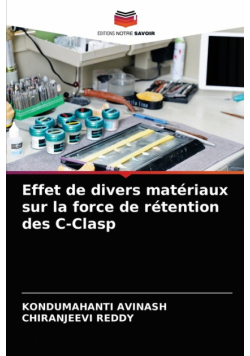Effet de divers matériaux sur la force de rétention des C-Clasp