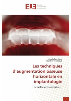 Les techniques d'augmentation osseuse horizontale en implantologie