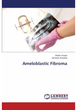 Ameloblastic Fibroma