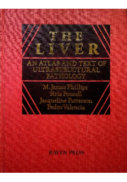 The liver An atlas and text of ultrastructural pathology