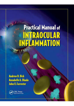 Practical Manual of Intraocular Inflammation