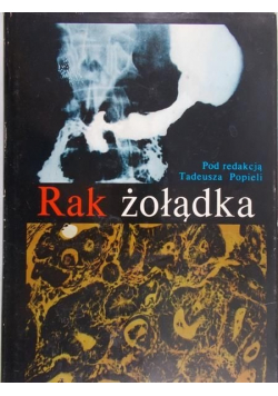 Rak żołądka