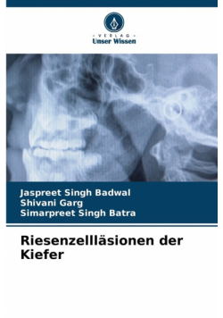 Riesenzellläsionen der Kiefer