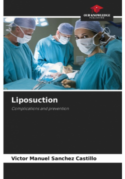 Liposuction