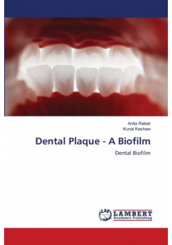 Dental Plaque - A Biofilm