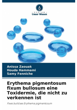 Erythema pigmentosum fixum bullosum eine Toxidermie, die nicht zu verkennen ist