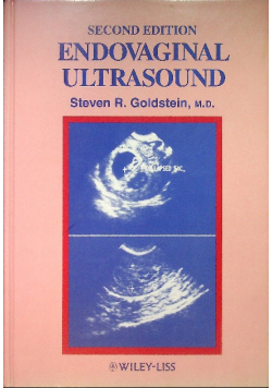 Endovaginal Ultrasound