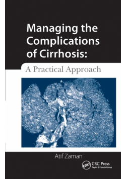 Managing the Complications of Cirrhosis