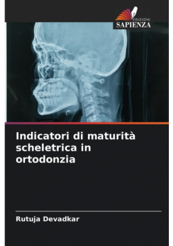 Indicatori di maturità scheletrica in ortodonzia