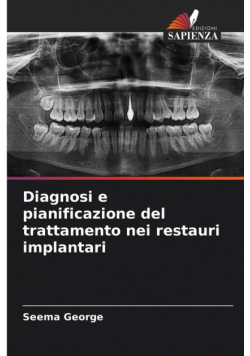 Diagnosi e pianificazione del trattamento nei restauri implantari