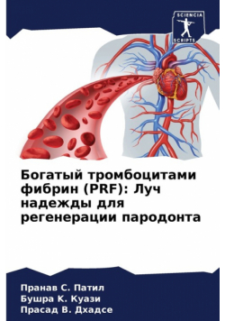 Богатый Тромбоцитами Фибрин (Prf)