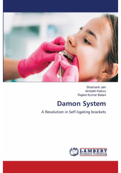 Damon System