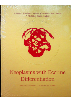 Neoplasms with Eccrine Differentiation