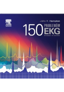 150 problemów EKG
