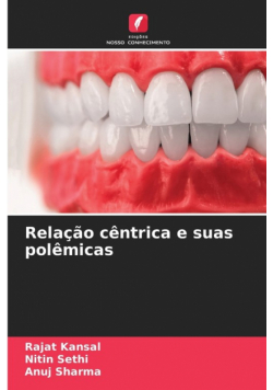 Relação cêntrica e suas polêmicas