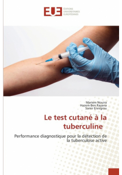 Le test cutané à la tuberculine