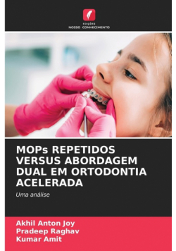 Mops Repetidos Versus Abordagem Dual Em Ortodontia Acelerada