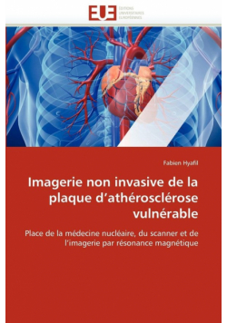 Imagerie non invasive de la plaque d''athérosclérose vulnérable