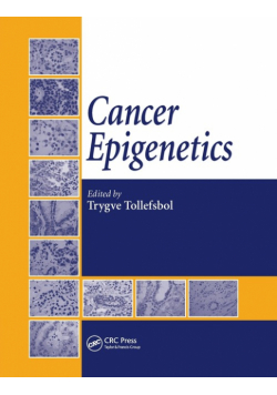 Cancer Epigenetics