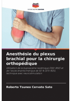 Anesthésie du plexus brachial pour la chirurgie orthopédique