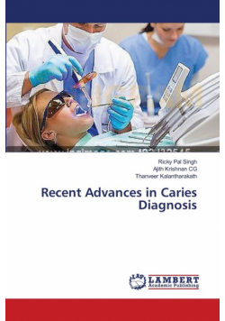 Recent Advances in Caries Diagnosis