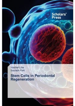 Stem Cells in Periodontal Regeneration