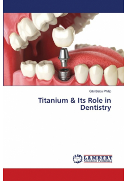 Titanium & Its Role in Dentistry