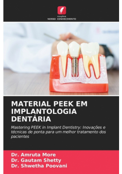 Material Peek Em Implantologia Dentária