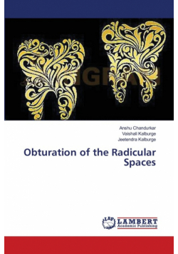 Obturation of the Radicular Spaces