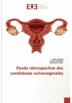 Etude rétrospective des candidoses vulvovaginales