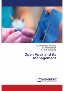 Open Apex and its Management