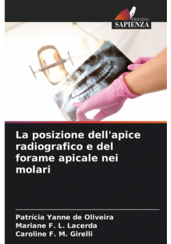 La posizione dell'apice radiografico e del forame apicale nei molari