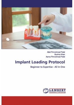 Implant Loading Protocol