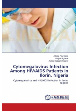 Cytomegalovirus Infection Among HIV/AIDS Patients in Ilorin, Nigeria