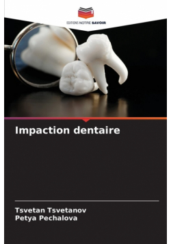 Impaction dentaire