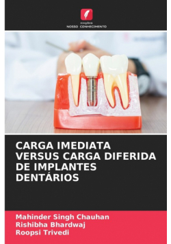 Carga Imediata Versus Carga Diferida De Implantes Dentários