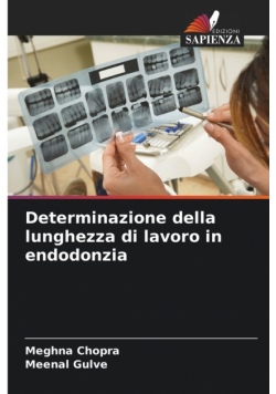 Determinazione della lunghezza di lavoro in endodonzia