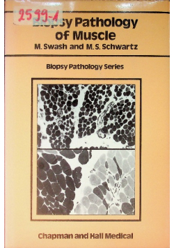 Biopsy pathology of muscle